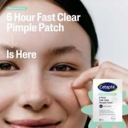 Cetaphil Gentle Clear 6 Hour Fast Clear Pimple Patches (24 Patches)